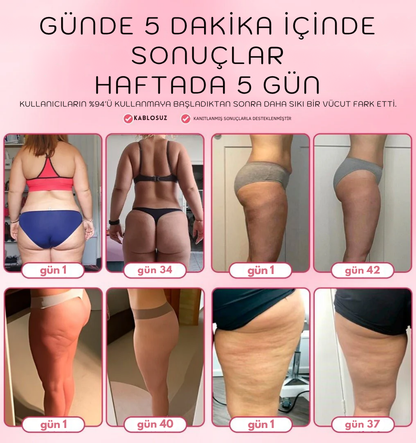 Felorae™ Selülit Masaj Aleti